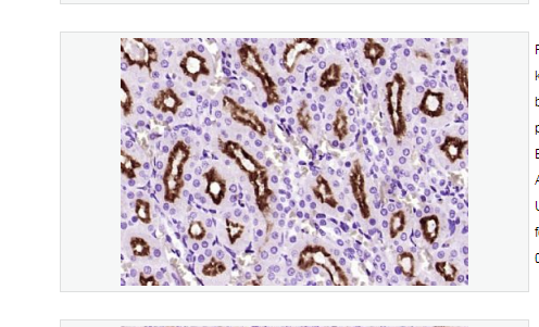 Anti-Klotho antibody-Klotho多肽蛋白抗體,Klotho