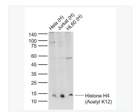 Anti-Histone H4 -乙?；M蛋白H4抗體,Histone H4 (Acetyl K12)