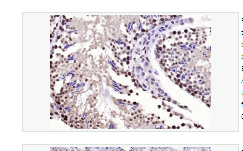 Anti-BPTF antibody -胎儿阿兹海默病抗原/核小体重塑因子抗体,BPTF