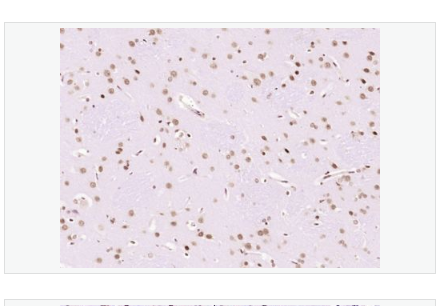 Anti-LMX1b antibody -指甲髕骨綜合征相關(guān)蛋白NPS1抗體,LMX1b