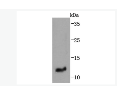 Anti-IGF2 antibody-胰岛素样生长因子-II重组兔单克隆抗体,IGF2