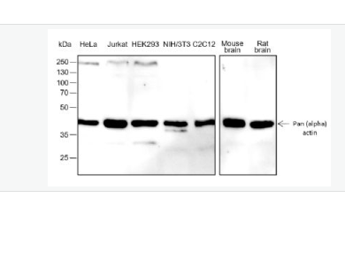 Anti-Pan Actin antibody-泛肌动蛋白重组兔单抗,Pan Actin
