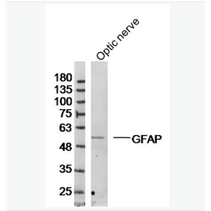 胶质纤维酸性蛋白抗体,GFAP