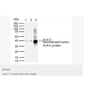Anti-HLA-C antibody-组织相容性蛋白1单克隆抗体,HLA-C