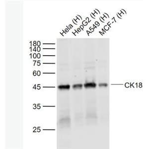 Anti-CK18 antibody-细胞角蛋白18单克隆抗体