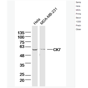 Anti-CK7 antibody-细胞角蛋白7单克隆抗体