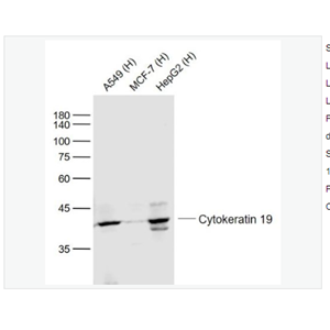 Anti-Cytokeratin 19 antibody-细胞角蛋白19单克隆抗体