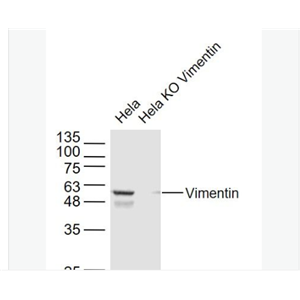 Anti-Vimentin antibody-波形蛋白抗体