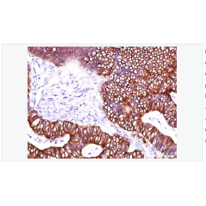 Anti-Cytokeratin 8 antibody-细胞角蛋白8单克隆抗体