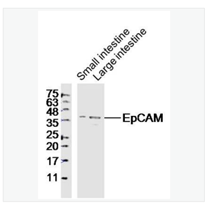 Anti-EpCAM antibody-上皮细胞粘附分子（CD326）抗体