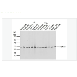 Anti-PSMA1 antibody-蛋白酶体PSMα1重组兔单克隆抗体