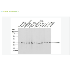 Anti-PSMA1 antibody-蛋白酶体PSMα1重组兔单克隆抗体,PSMA1