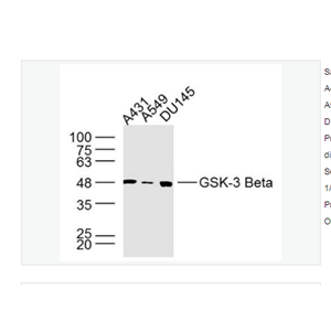 Anti-GSK-3 Beta antibody-糖原合酶激酶-3β单克隆抗体