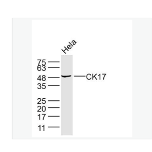 Anti-CK17 antibody-细胞角蛋白17单克隆抗体