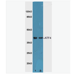 Anti-ATF4 antibody-活化轉(zhuǎn)錄因子4抗體,ATF4