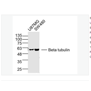 Anti-Beta tubulin-微管蛋白β tubulin/Tubulin β（内参）单克隆抗体,Beta tubulin (Loading Control)