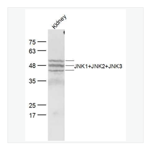 Anti-JNK1+JNK2+JNK3 antibody-氨基末端激酶1/2/3抗体,JNK1+JNK2+JNK3