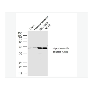 Anti-alpha smooth muscle -肌动蛋白α/α-SMA/α Actin抗体
