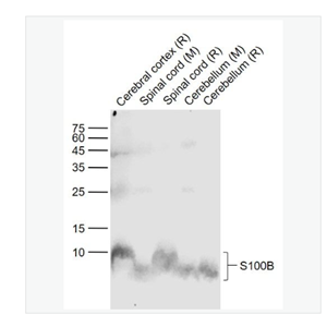 Anti-S100B antibody -S100B蛋白单克隆抗体,S100B