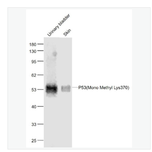 Anti-P53 -甲基化P53(Mono Methyl Lys370)单克隆抗体