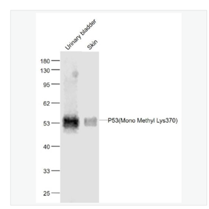 Anti-P53 -甲基化P53(Mono Methyl Lys370)单克隆抗体,Histone H3.1