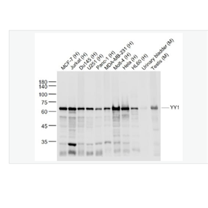 Anti-YY1 -核转录调节因子YY1 （核内参）重组兔单克隆抗体