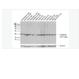 Anti-CSNK2B-丝/苏氨酸蛋白激酶II β重组兔单克隆抗体