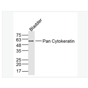 Anti-Pan Cytokeratin antibody-广谱细胞角蛋白PCK抗体,Pan Cytokeratin