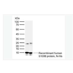 Anti-S100B antibody -人S100B蛋白多克隆抗体,S100B