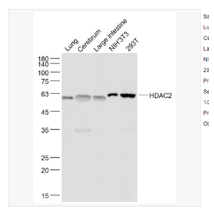 Anti-HDAC2 antibody -组蛋白去乙酰化酶2重组兔单克隆抗体