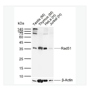 Anti-Rad51 antibody  -Rad51重组兔单克隆抗体