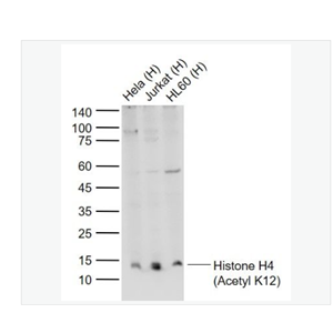 Anti-Histone H4 -乙酰化组蛋白H4抗体
