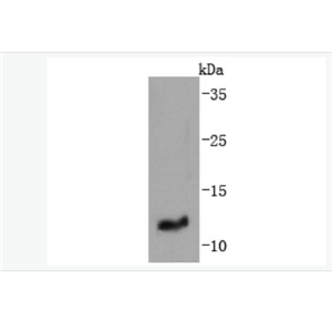 Anti-IGF2 antibody-胰岛素样生长因子-II重组兔单克隆抗体