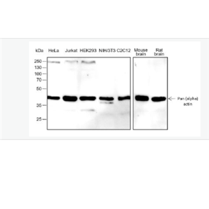 Anti-Pan Actin antibody-泛肌动蛋白重组兔单抗,Pan Actin