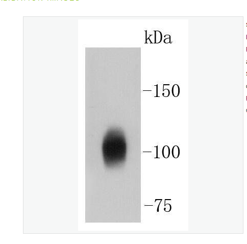 Anti-Sodium Potassium ATPase-钠钾ATP酶蛋白a1（内参）重组兔单克隆抗体,Sodium Potassium ATPase(Loading Control)