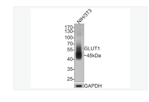 Anti-GLUT1 antibody-葡萄糖转运蛋白1重组兔单克隆抗体,GLUT1