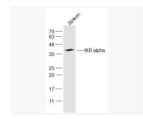 Anti-IKB alpha antibody-核因子κB抑制蛋白α抗體,IKB alpha