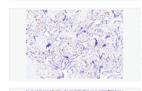 Anti-CD163 antibody -CD163重組兔單克隆抗體,CD163