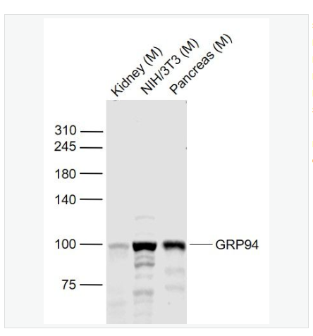 Anti-GRP94 antibody -葡萄糖调节蛋白94抗体,GRP94