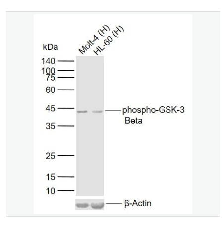 Anti-phospho-GSK-3 Beta -磷酸化糖原合酶激酶-3β单克隆抗体,phospho-GSK-3 Beta (Ser9)