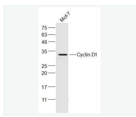 Anti-Cyclin D1 antibody -周期素D1抗体,Cyclin D1