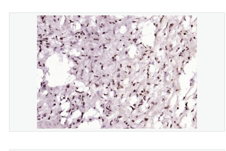 Anti-p53 (Acetyl K382) antibody  -乙?；疨53(Lys382)抗體,p53 (Acetyl K382)