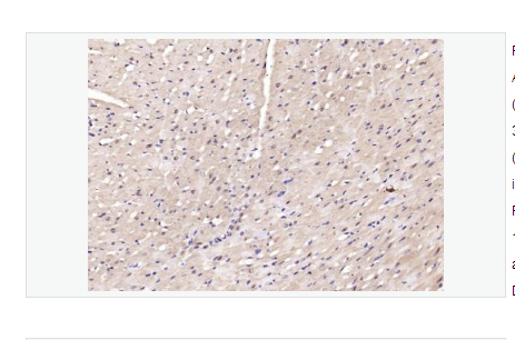 Anti-phospho-AMPK alpha-2  -磷酸化腺苷單磷酸活化蛋白激酶α2抗體,phospho-AMPK alpha-2 (Thr172)