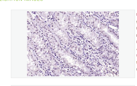 Anti-SIK1 antibody  -丝氨酸/苏氨酸蛋白激酶SIK1抗体,SIK1