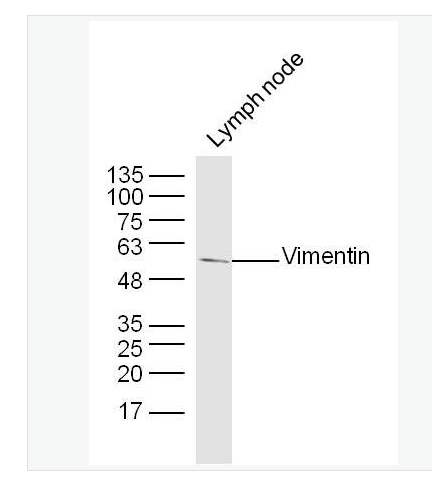Anti-Vimentin antibody- 波形蛋白抗体,Vimentin