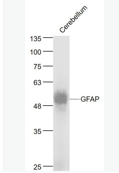 Anti-GFAP antibody- 胶质纤维酸性蛋白单克隆抗体,GFAP