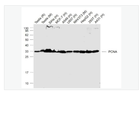 Anti-PCNA - 增殖細(xì)胞核抗原（核內(nèi)參）重組兔單克隆抗體,PCNA (Nuclear Loading Control)