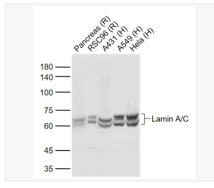 Anti-Lamin A/C antibody- 核纤层蛋白A抗体,Lamin A/C