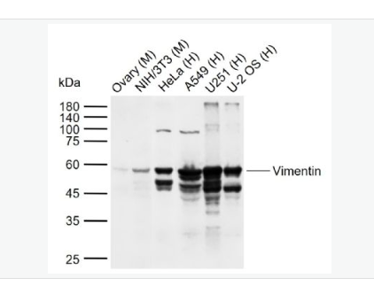 Anti-Vimentin antibody - 波形蛋白抗体,Vimentin