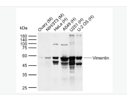 Anti-Vimentin antibody - 波形蛋白抗體,Vimentin